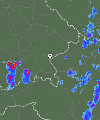 Radar