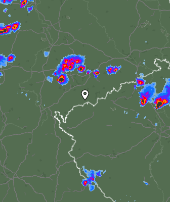 Radar
