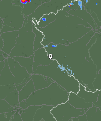 Radar