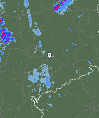 Radar
