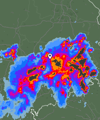 Radar