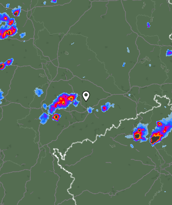 Radar