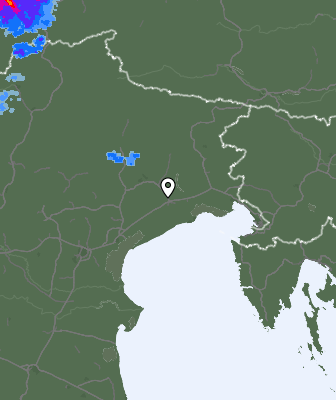 Radar