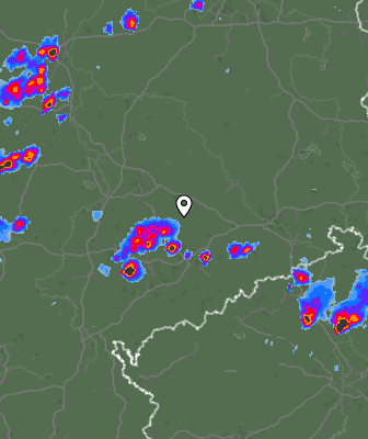 Radar