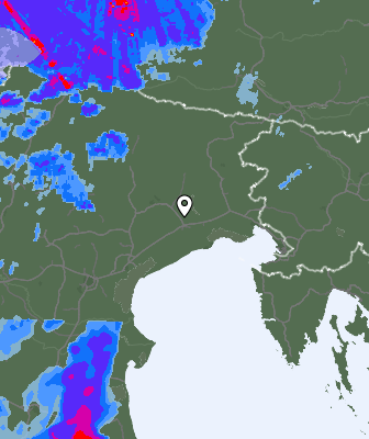 Radar