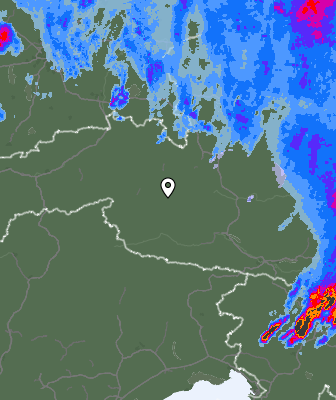 Radar