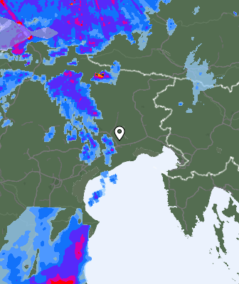 Radar