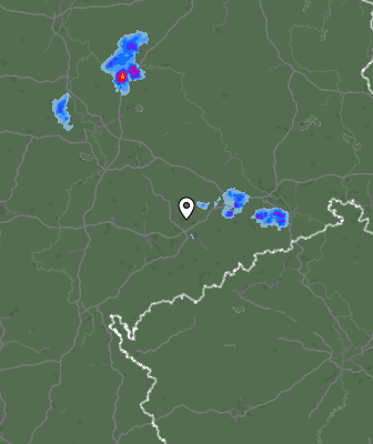 Radar