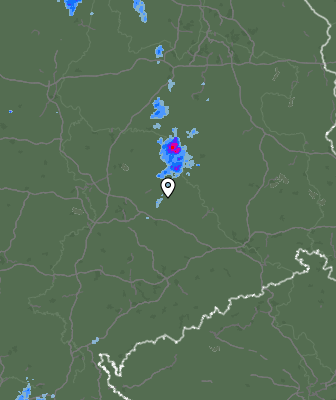 Radar