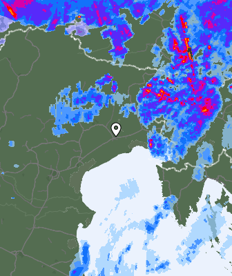 Radar