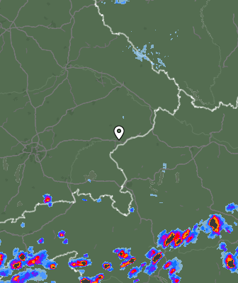Radar
