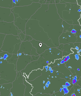 Radar