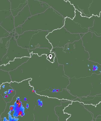 Radar
