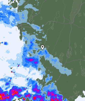 Radar