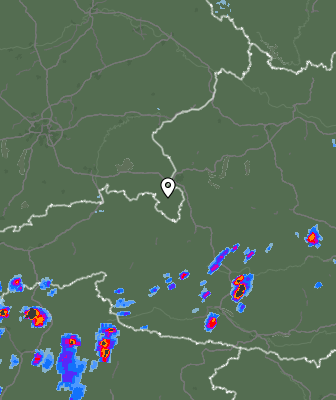 Radar