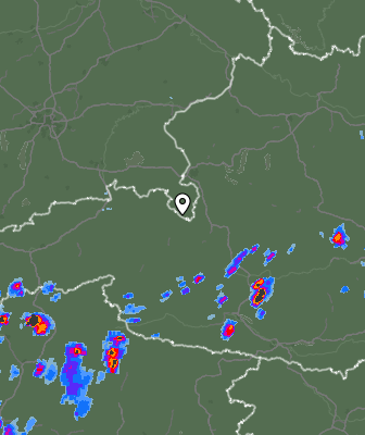 Radar