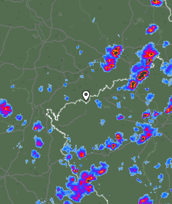 Radar