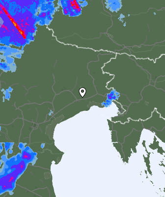 Radar