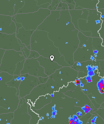 Radar