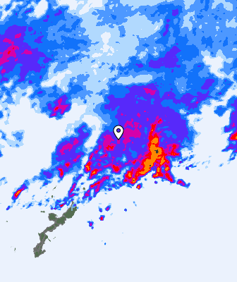 Radar