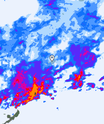 Radar