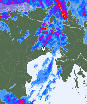 Radar