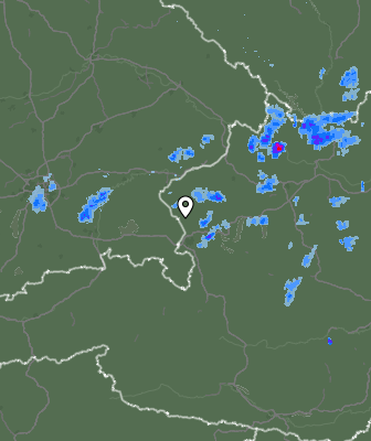 Radar