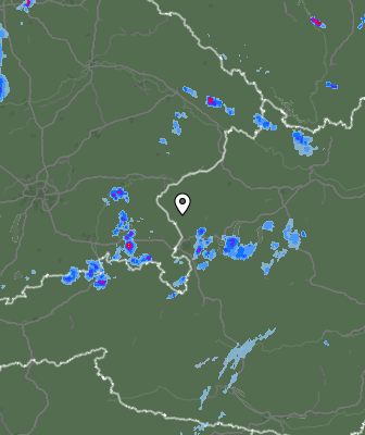 Radar