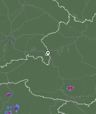 Radar