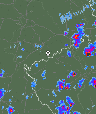 Radar