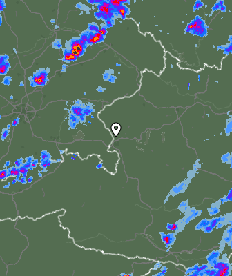 Radar