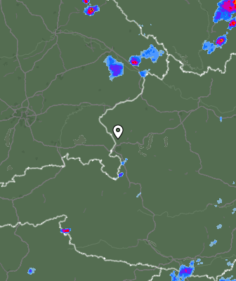 Radar