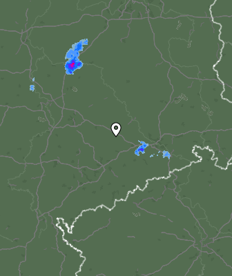 Radar