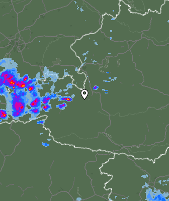 Radar