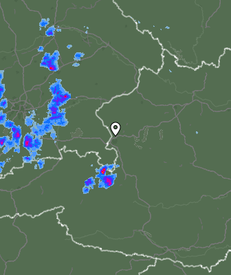 Radar
