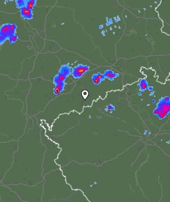 Radar
