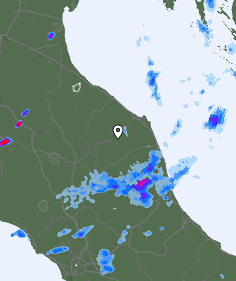 Radar