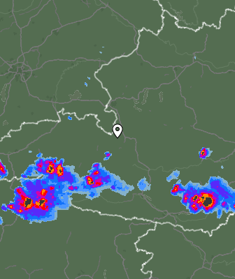 Radar