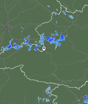 Radar