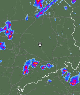 Radar