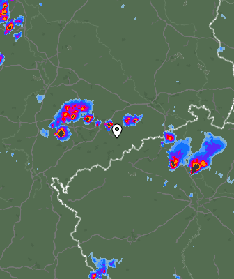 Radar
