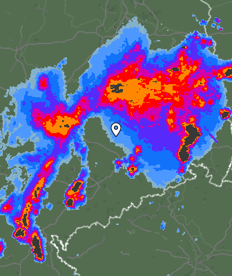 Radar