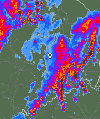 Radar