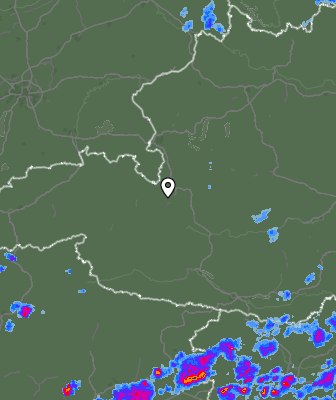Radar