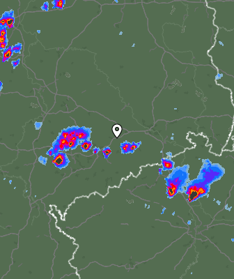 Radar