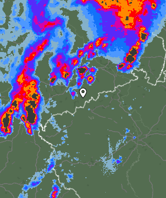 Radar