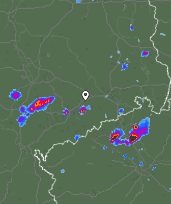 Radar