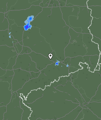 Radar