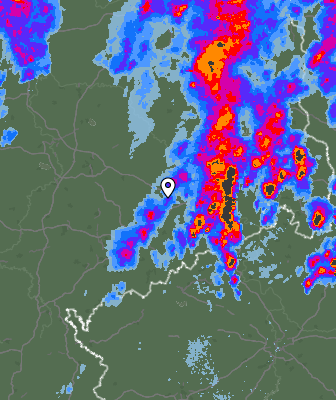 Radar