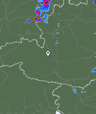 Radar